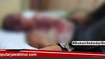 Kepergok Curi Motor, Warga Probolinggo Dihajar Masa Hingga Masuk Rumah Sakit